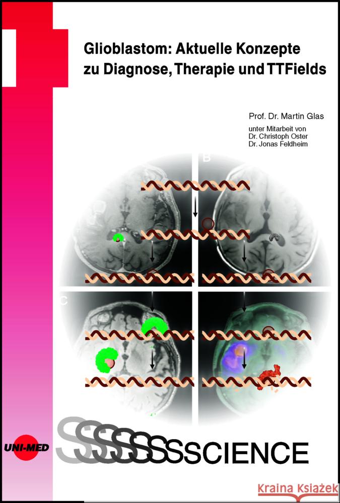 Glioblastom: Aktuelle Konzepte zu Diagnose, Therapie und TTFields Glas, Martin 9783837416794 UNI-MED, Bremen