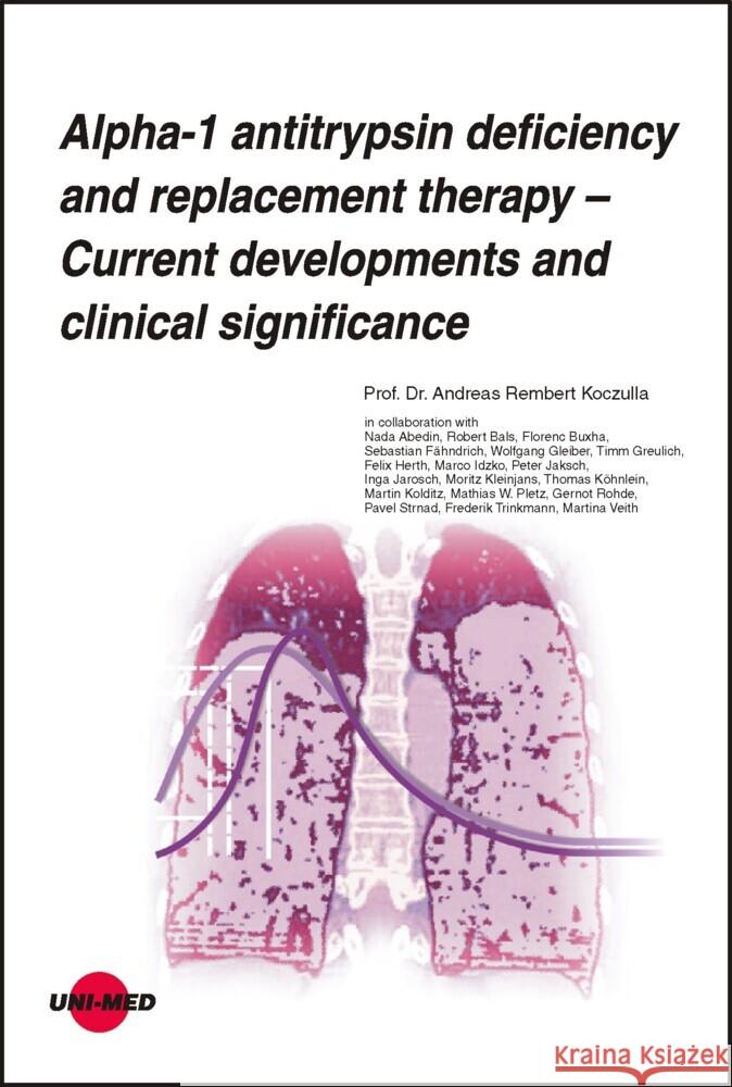 Alpha-1 antitrypsin deficiency and replacement therapy - Current developments and clinical significance Koczulla, Andreas Rembert 9783837424249 UNI-MED, Bremen