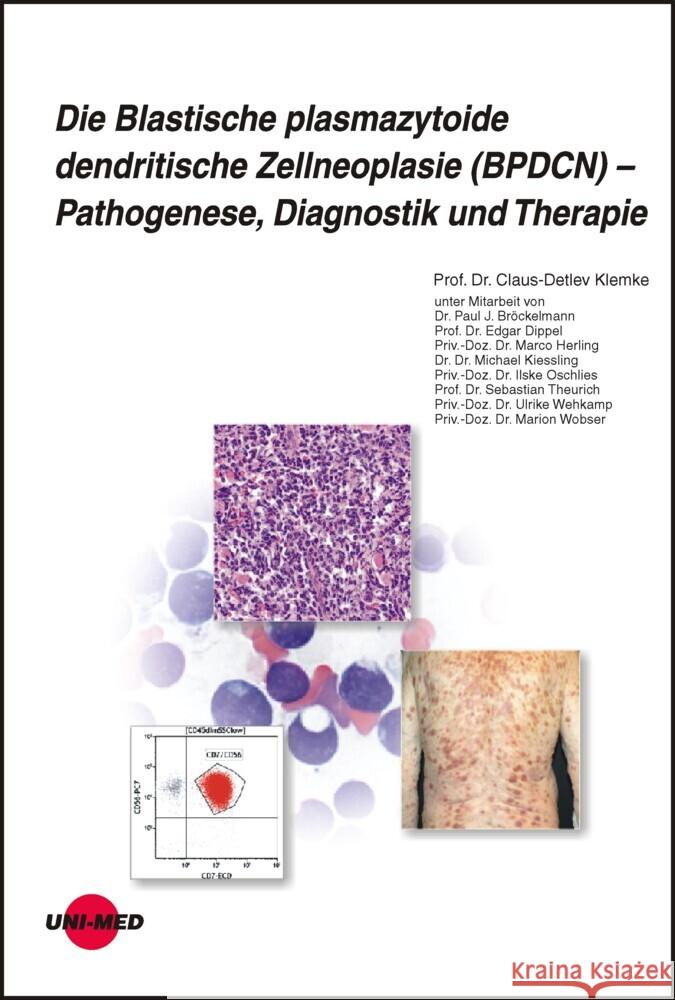 Die Blastische plasmazytoide dendritische Zellneoplasie (BPDCN) - Pathogenese, Diagnostik und Therapie Klemke, Claus-Detlev 9783837424324 UNI-MED, Bremen