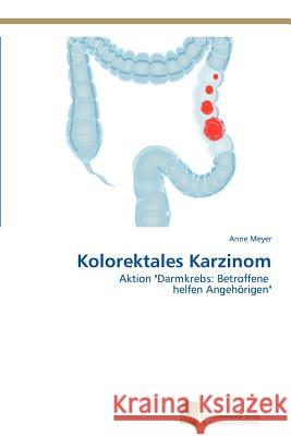 Kolorektales Karzinom Anne Meyer 9783838116914