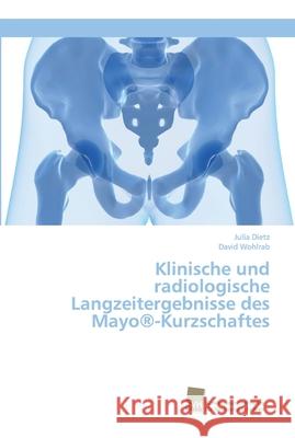 Klinische und radiologische Langzeitergebnisse des Mayo(R)-Kurzschaftes Dietz, Julia 9783838153544 Südwestdeutscher Verlag für Hochschulschrifte