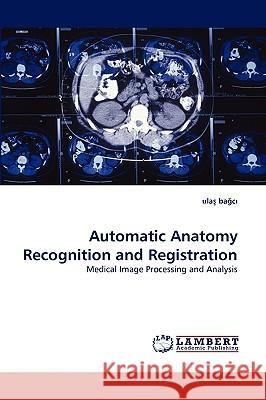 Automatic Anatomy Recognition and Registration Ulaş Bağcı 9783838380148 LAP Lambert Academic Publishing