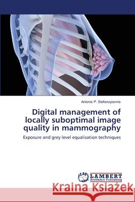 Digital management of locally suboptimal image quality in mammography Antonis P Stefanoyiannis 9783838380421 LAP Lambert Academic Publishing