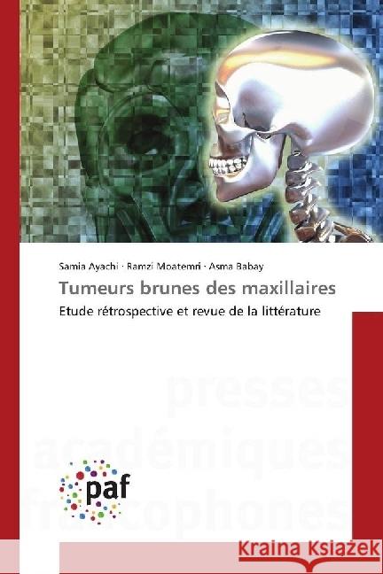 Tumeurs brunes des maxillaires : Etude rétrospective et revue de la littérature Ayachi, Samia; Moatemri, Ramzi; Babay, Asma 9783841625618 Presses Académiques Francophones