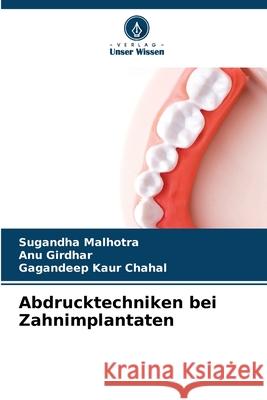 Abdrucktechniken bei Zahnimplantaten Malhotra, Sugandha, Girdhar, ANU, Chahal, Gagandeep kaur 9783841640147