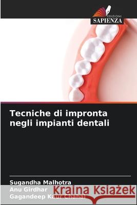 Tecniche di impronta negli impianti dentali Malhotra, Sugandha, Girdhar, ANU, Chahal, Gagandeep kaur 9783841640680