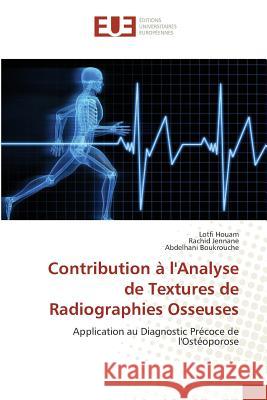 Contribution À l'Analyse de Textures de Radiographies Osseuses Collectif 9783841670410 Editions Universitaires Europeennes