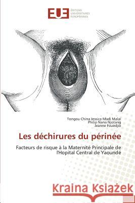 Les Déchirures Du Périnée China-T 9783841673794