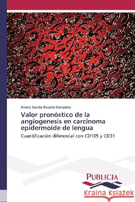 Valor pronóstico de la angiogenesis en carcinoma epidermoide de lengua : Cuantificación diferencial con CD105 y CD31 García-Rozado González, Alvaro 9783841681904