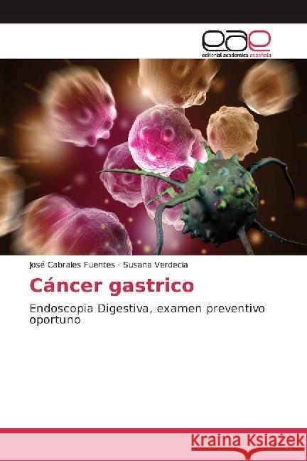 Cáncer gastrico : Endoscopia Digestiva, examen preventivo oportuno Cabrales Fuentes, José; Verdecia, Susana 9783841753892