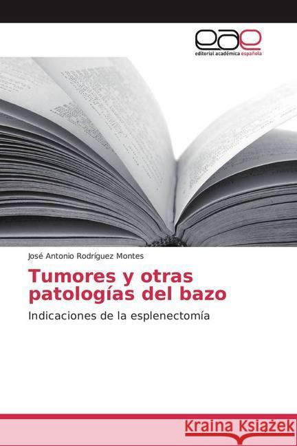 Tumores y otras patologías del bazo : Indicaciones de la esplenectomía Rodríguez Montes, José Antonio 9783841757302