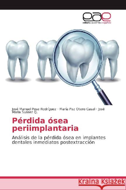 Pérdida ósea periimplantaria : Análisis de la pérdida ósea en implantes dentales inmediatos postextracción Pose Rodríguez, José Manuel; Otero Casal, María Paz; Suárez Q., José María 9783841761538