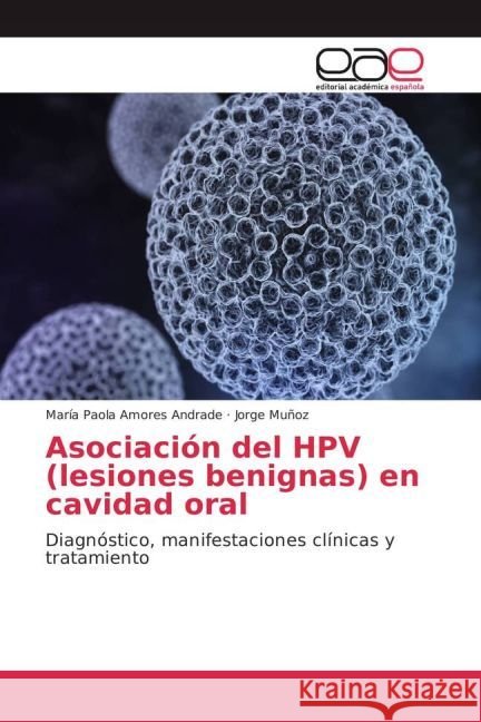 Asociación del HPV (lesiones benignas) en cavidad oral : Diagnóstico, manifestaciones clínicas y tratamiento Amores Andrade, María Paola; Muñoz, Jorge 9783841767721
