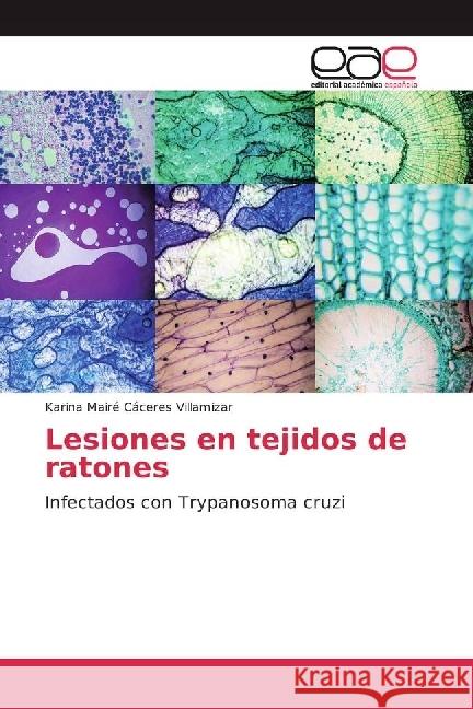 Lesiones en tejidos de ratones : Infectados con Trypanosoma cruzi Cáceres Villamizar, Karina Mairé 9783841769602 Editorial Académica Española