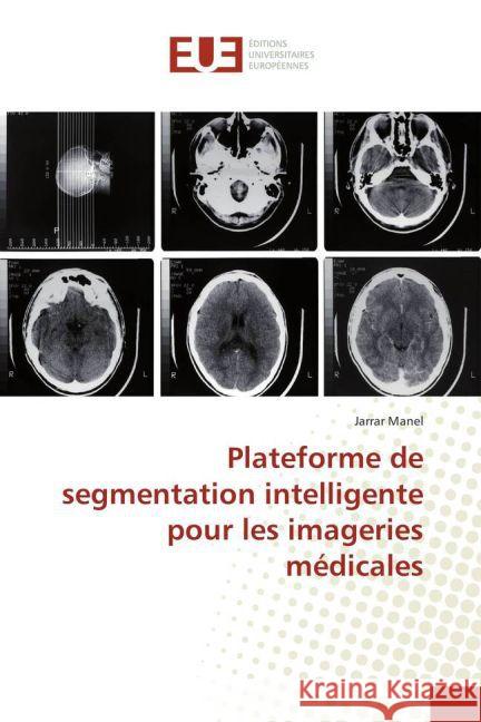 Plateforme de segmentation intelligente pour les imageries médicales Manel, Jarrar 9783841778291