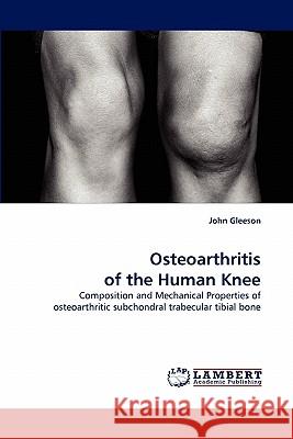 Osteoarthritis of the Human Knee  9783843382502 LAP Lambert Academic Publishing AG & Co KG