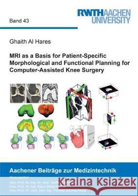 MRI as a Basis for Patient-Specific Morphological and Functional Planning for Computer-Assisted Knee Surgery  9783844052022 Shaker Verlag GmbH, Germany