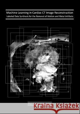 Machine Learning in Cardiac CT Image Reconstruction Tanja Loßau 9783844073539 Shaker Verlag GmbH, Germany