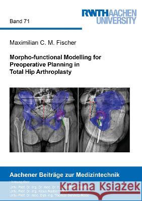 Morpho-functional Modelling for Preoperative Planning in Total Hip Arthroplasty Maximilian C. M. Fischer 9783844086713