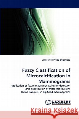 Fuzzy Classification of Microcalcification in Mammograms Agustinus Praba Drijarkara 9783844320633