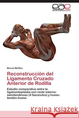 Reconstrucción del Ligamento Cruzado Anterior de Rodilla Malillos Manuel 9783844346367