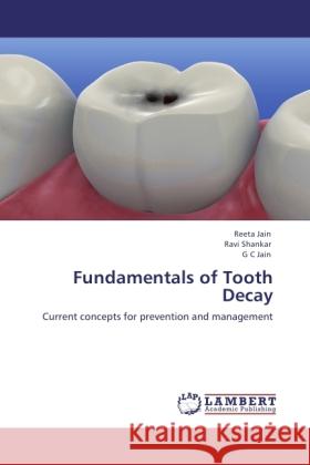 Fundamentals of Tooth Decay Jain, Reeta, Shankar, Ravi, Jain, G. C. 9783844387780