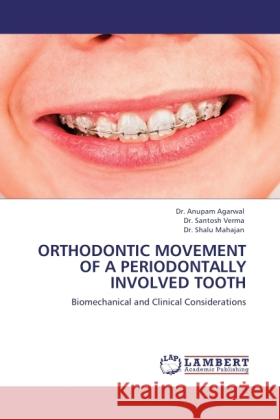 ORTHODONTIC MOVEMENT OF A PERIODONTALLY INVOLVED TOOTH Agarwal, Anupam, Verma, Santosh, Mahajan, Shalu 9783845419565