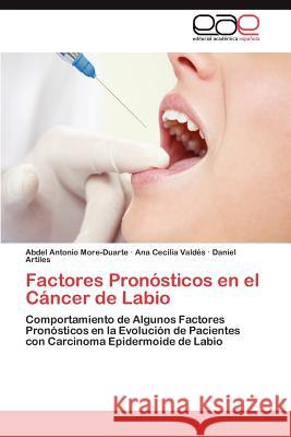 Factores Pronósticos en el Cáncer de Labio More-Duarte Abdel Antonio 9783845499024