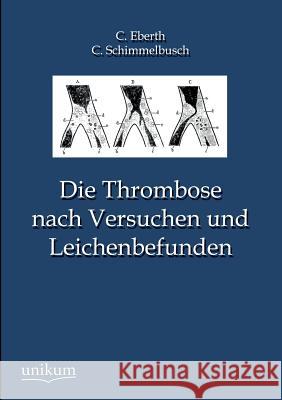 Die Thrombose Nach Versuchen Und Leichenbefunden Eberth, C. 9783845745565 UNIKUM