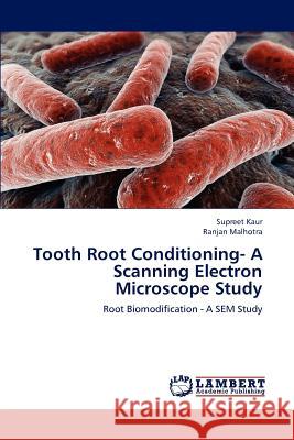 Tooth Root Conditioning- A Scanning Electron Microscope Study Supreet Kaur Ranjan Malhotra 9783846520765 LAP Lambert Academic Publishing