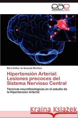 Hipertensión Arterial: Lesiones precoces del Sistema Nervioso Central de Quesada Martinez Maria Esther 9783846565308 Editorial Acad Mica Espa Ola