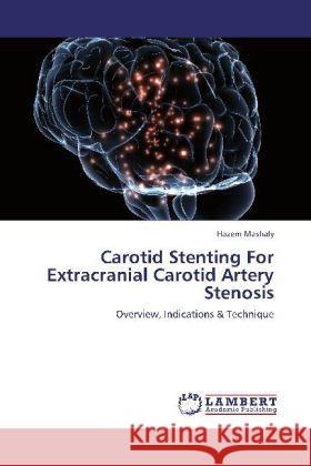 Carotid Stenting For Extracranial Carotid Artery Stenosis Mashaly, Hazem 9783846584651