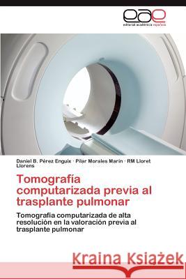 Tomografía computarizada previa al trasplante pulmonar Pérez Enguix Daniel B 9783847353720 Editorial Acad Mica Espa Ola
