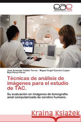 Técnicas de análisis de imágenes para el estudio de TAC. Valdés Torres José Armando 9783847356028