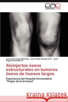 Aloinjertos óseos estructurales en tumores óseos de huesos largos López Martínez Juan José 9783847358985 Editorial Acad Mica Espa Ola