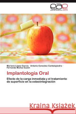 Implantología Oral López García Mariano 9783847367901 Editorial Acad Mica Espa Ola