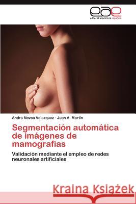 Segmentación automática de imágenes de mamografías Novoa Velazquez Andra 9783847367956