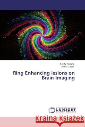 Ring Enhancing lesions on Brain Imaging Krishna, Kavita, Gupta, Ankur 9783848420155