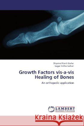 Growth Factors vis-a-vis Healing of Bones Guha, Shyamal Kanti, Sarkar, Sagar Tirtha 9783848431526