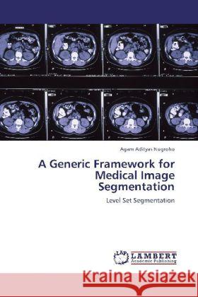 A Generic Framework for Medical Image Segmentation Nugroho, Agam Adityas 9783848442553