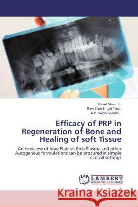 Efficacy of PRP in Regeneration of Bone and Healing of soft Tissue Sharma, Rahul, Toor, Ravi Sher Singh, Sandhu, A.P. Singh 9783848445974