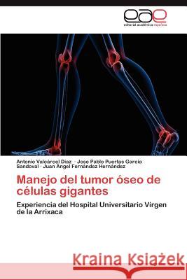 Manejo del tumor óseo de células gigantes Valcárcel Díaz Antonio 9783848451401 Editorial Acad Mica Espa Ola