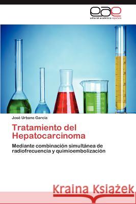 Tratamiento del Hepatocarcinoma Jos Urban 9783848454877 Editorial Acad Mica Espa Ola