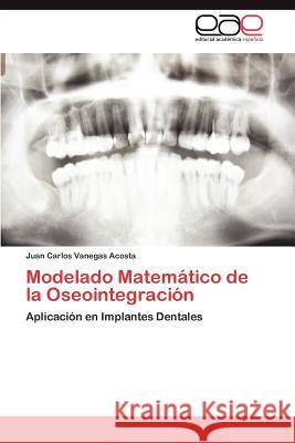 Modelado Matematico de La Oseointegracion Vanegas Acosta, Juan Carlos 9783848458493 Editorial Acad Mica Espa Ola