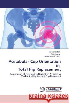 Acetabular Cup Orientation in Total Hip Replacement Abhishek Kini, Dr Ajith Kumar, Shantharam Shetty 9783848480722