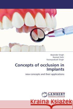 Concepts of occlusion in Implants Singh, Barjinder, Sohi, Navreet, Singh, Karanprakash 9783848486960