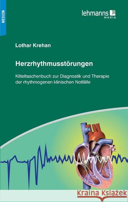Herzrhythmusstörungen : Kitteltaschenbuch zur Diagnostik und Therapie der rhythmogenen klinischen Notfälle Krehan, Lothar 9783865419194 Lehmanns Media