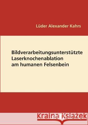 Bildverarbeitungsunterstützte Laserknochenablation am humanen Felsenbein Lüder Alexander Kahrs 9783866444584