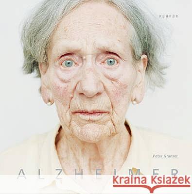 Alzheimer Peter Granser 9783868280388 Kehrer Verlag