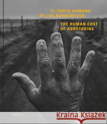 The Human Cost: Agrotoxins in Argentina Pablo E Piovano 9783868287677 Kehrer Verlag